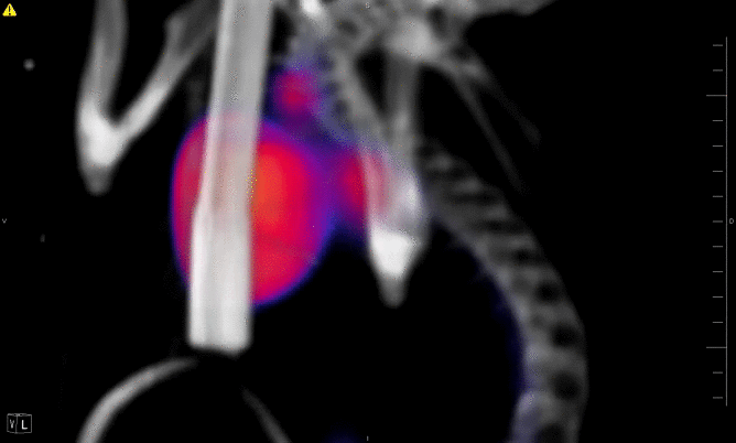 Animated image of PET/CT showing heart and bone structure
