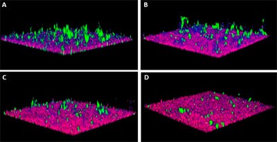 3 species biofilm Demuth lab