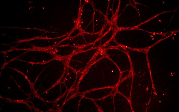 blood vessels grown in culture from rat adipose