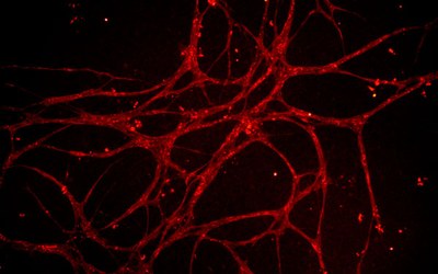 blood vessels grown in culture from rat adipose