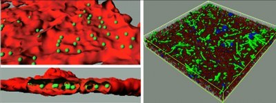 Confocal Biofilm