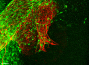 Neural Crest Schwann Cells and Cochleovestibular Neurons