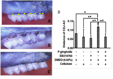 Periodontitis GSK3 inhibition