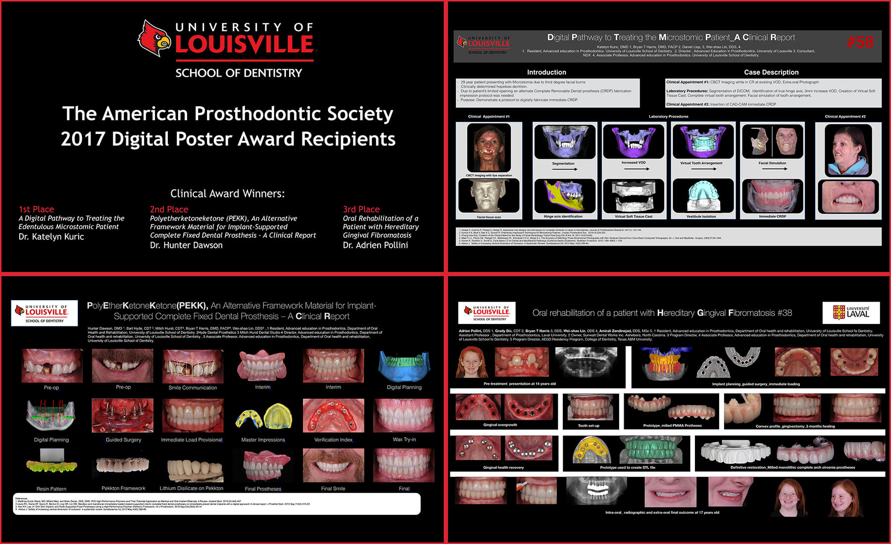 2017 Prosthodontic Posters