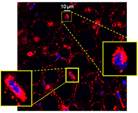 confocal-no