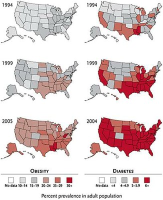 obesity-us