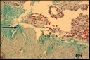 trichrome stain of rat lung section to show collagen
