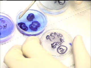 Staining Rat Brain for Infarct