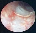 endoscopy image