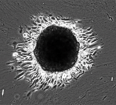 Cancer cell-ECM interactions in metastasis