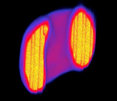 Rat Infarct Heart FDG