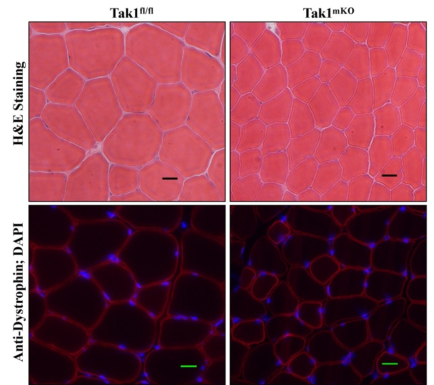 From black hat to white hat:  Findings tip assumptions about TAK1 in muscle growth