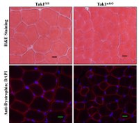 From black hat to white hat:  Findings tip assumptions about TAK1 in muscle growth