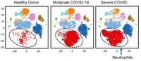 UofL immunologist discovers biomarker warning of cellular crisis that could cause death in COVID-19 patients