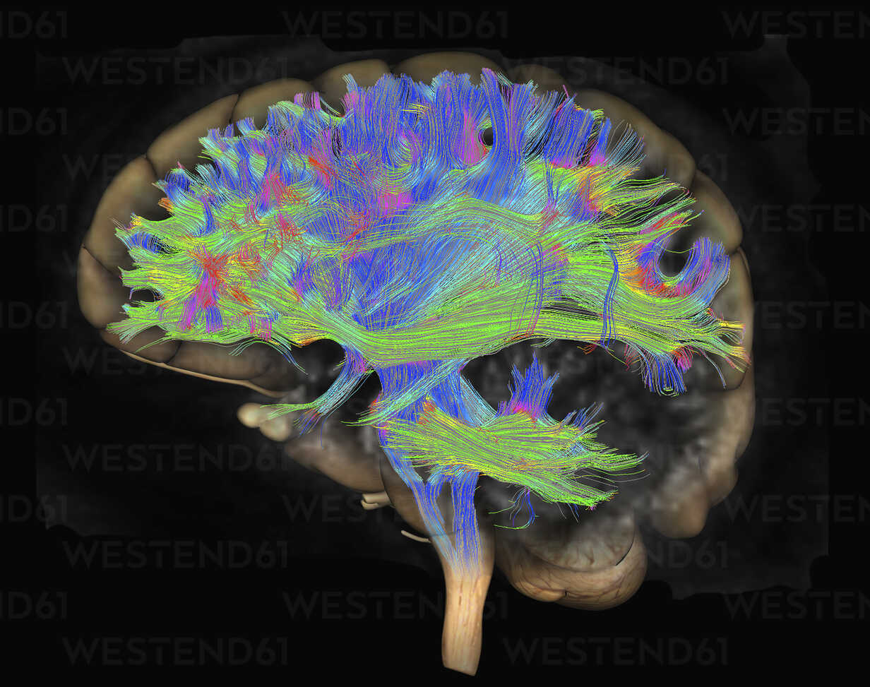 UofL researchers develop AI-powered tool to diagnose autism earlier