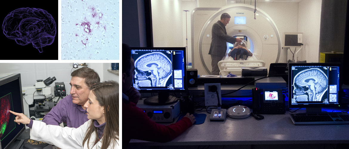 group of photos depicting a brain scan procedure, two people reviewing a brain scan on a computer screen, and illustrations of a brain and prion