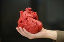3D model of child’s heart helps surgeons save life
